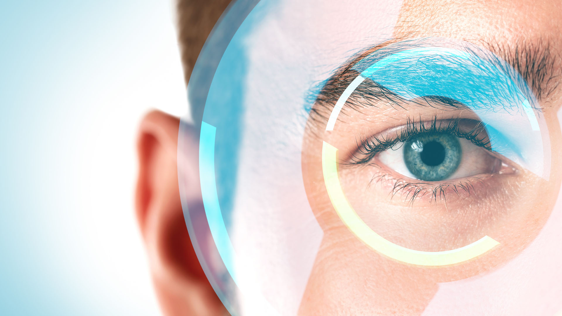 SMILE Lazer mi, LASIK mi? Hangisi Daha İyi?